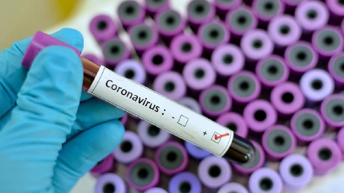 Pemerintah akan Tanggung Biaya Berobat Pasien Terkonfirmasi Virus Corona
