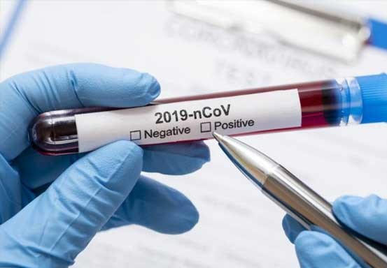 Riset Vaksin Anti-Covid-19 UEA Menunjukkan Hasil Positif