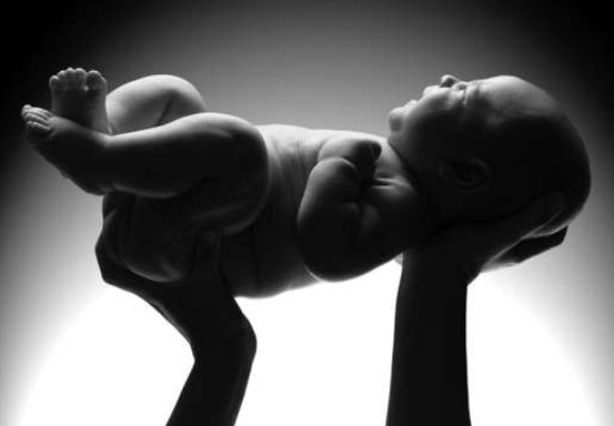 Langka, Bayi di Israel Lahir dalam Kondisi Mengandung
