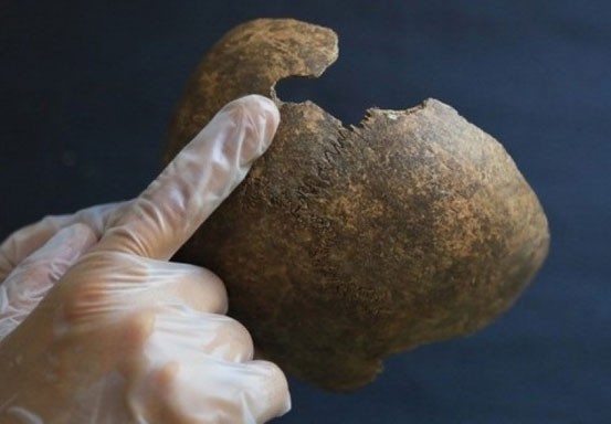 Temuan Arkeolog Ungkap Bedah Saraf 2.200 Tahun Lalu