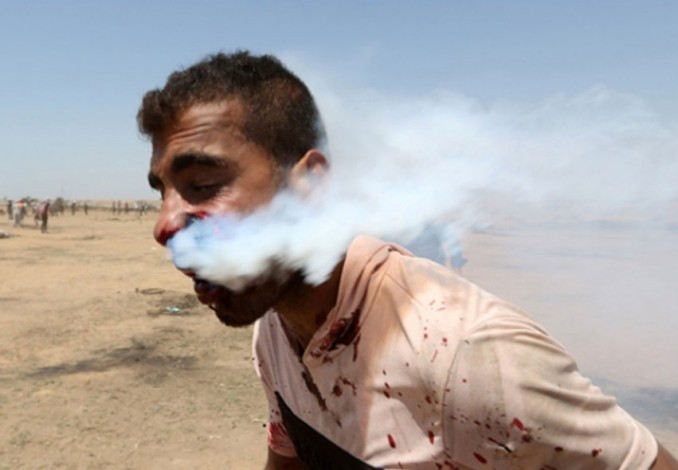 Ngeri, Tabung Gas Air Mata Tertancap di Pipi Warga Palestina