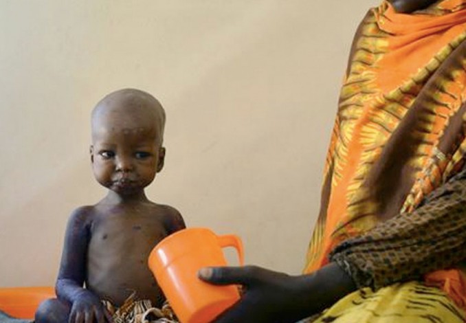 Resiko Kematian Massal Akibat Kelaparan Tinggi Di Afrika