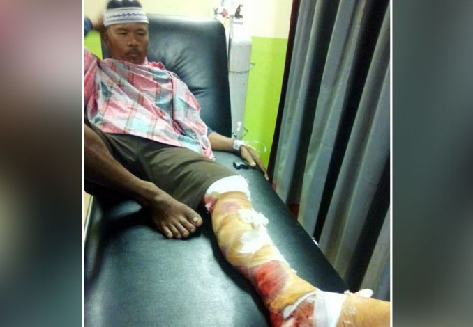 Cerita Pak Selamat Berjuang Melepaskan Kaki dari Gigitan Buaya di Kampar