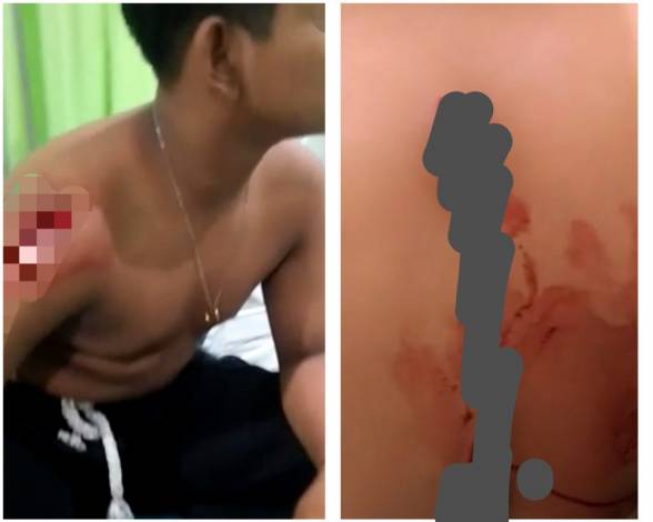 Video Viral Korban Begal Berdarah-darah Bukan di Pekanbaru, Polisi: Kami Cari yang Menyebarkan