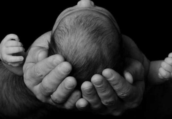 Bayi Bermata Satu Lahir di Sumut, Begini Penjelasan Dokter