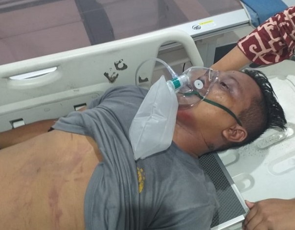 7 Polisi Terluka dalam Unjuk Rasa di Depan Mapolda Riau
