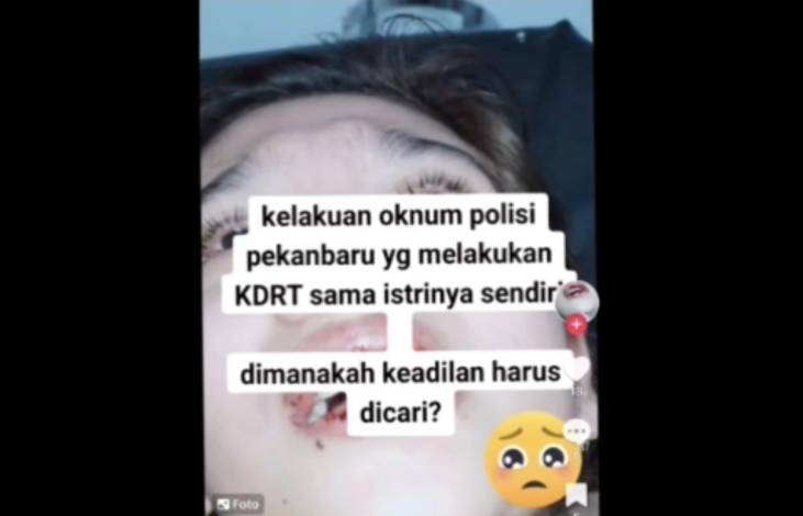 Viral di Sosmed, Istri Oknum Polisi Pekanbaru Ngaku Alami KDRT