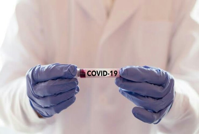 1 dari 2 Orang Indonesia yang Tes PCR Hari Ini Positif Covid