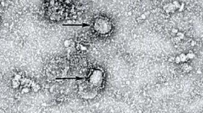 Ini Penampakan Pertama Foto Mikroskop Virus Corona