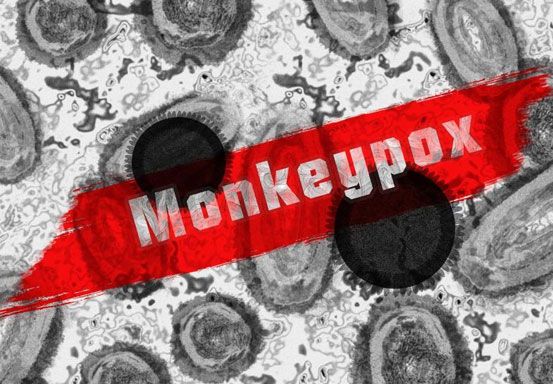 Hubungan Homoseksual Diduga Pemicu Utama Penyebaran Monkeypox