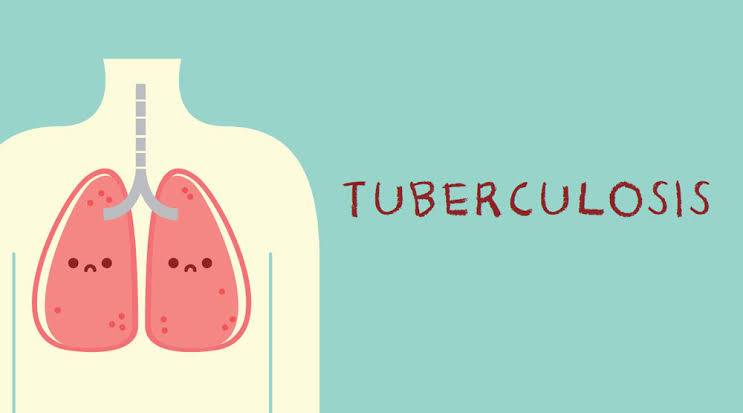13.007 Orang di Riau Kena Penyakit TBC