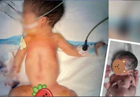 Bayi dengan empat tangan dan empat kaki di China. ©SCMP composite
