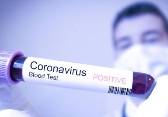 Sopir Bus di Jepang Terjangkit Virus Corona Usai Ajak Warga Wuhan Plesiran