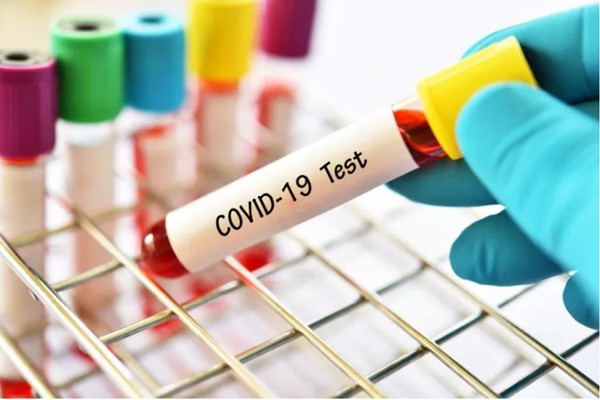 Kabar Baik, Hasil Uji Swab Pertama 9 Pasien Covid-19 di Riau Negatif
