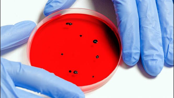 Deretan Fakta Virus Hendra yang Disebut Berpotensi Jadi Pandemi Selanjutnya